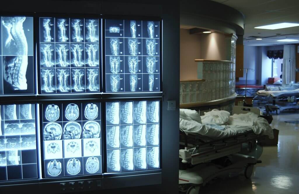 X rays