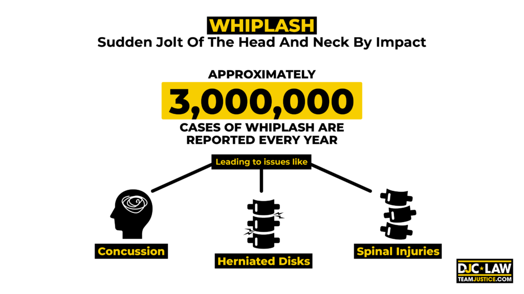 Image depicting whiplash, a sudden neck pain often resulting from car accidents, falls, or sports injuries.