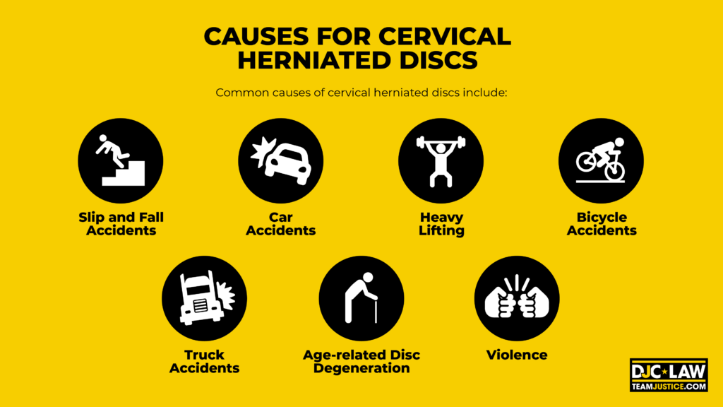 Diagram illustrating various causes of cervical herniated discs, including injury, aging, and repetitive strain.