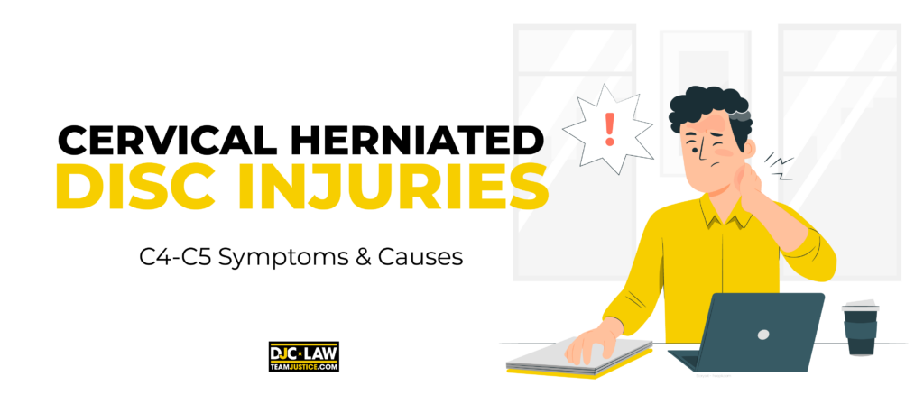 Diagram showing cervical herniated disc injuries, emphasizing the displacement of discs and potential nerve impact.